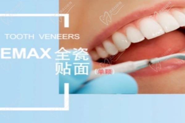 E-MAX全瓷牙貼面