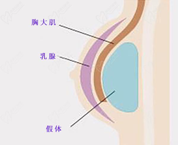 蘇州聶志宏隆胸技術(shù)優(yōu)勢(shì)