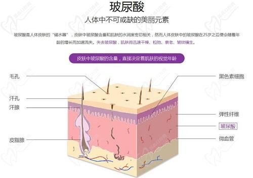 潤洛薇玻尿酸適合打哪里