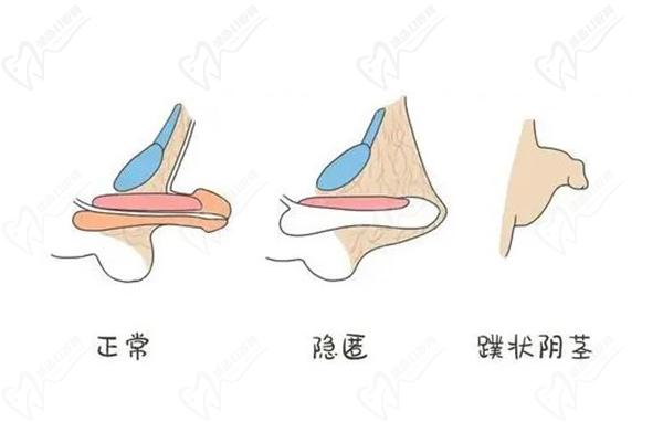 24小時(shí)男科在線咨詢平臺(tái)在線問診