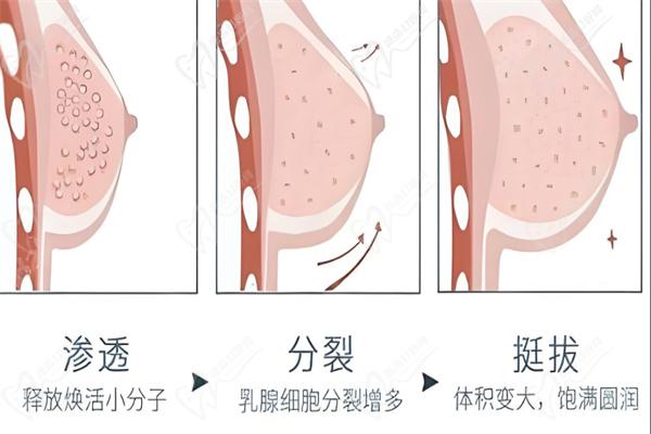 廈門林高萍豐胸價格表