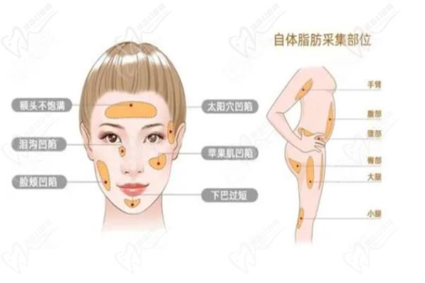 劉中 國登上中 國脂肪填充好的醫(yī)生排名